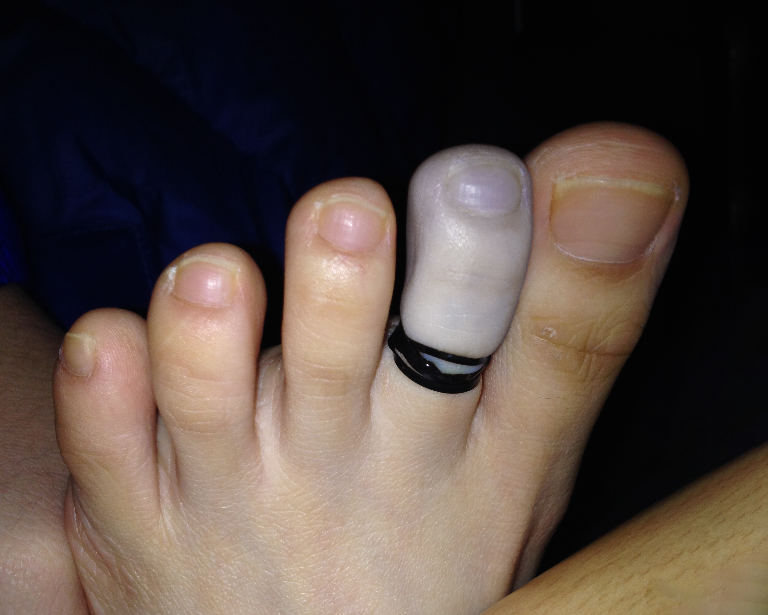Beautiful Tied Up Toes — 24