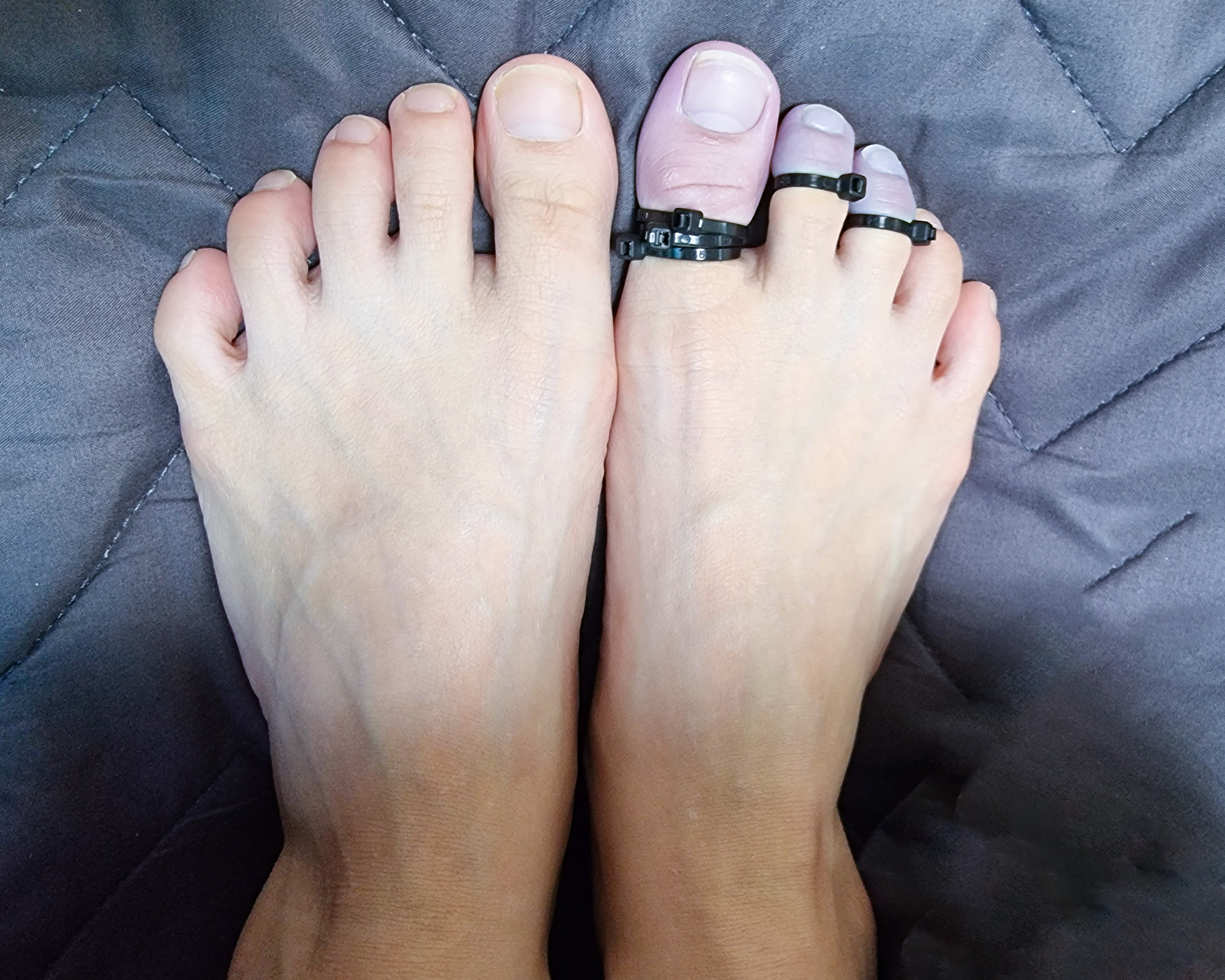 Beautiful Tied Up Toes — 23
