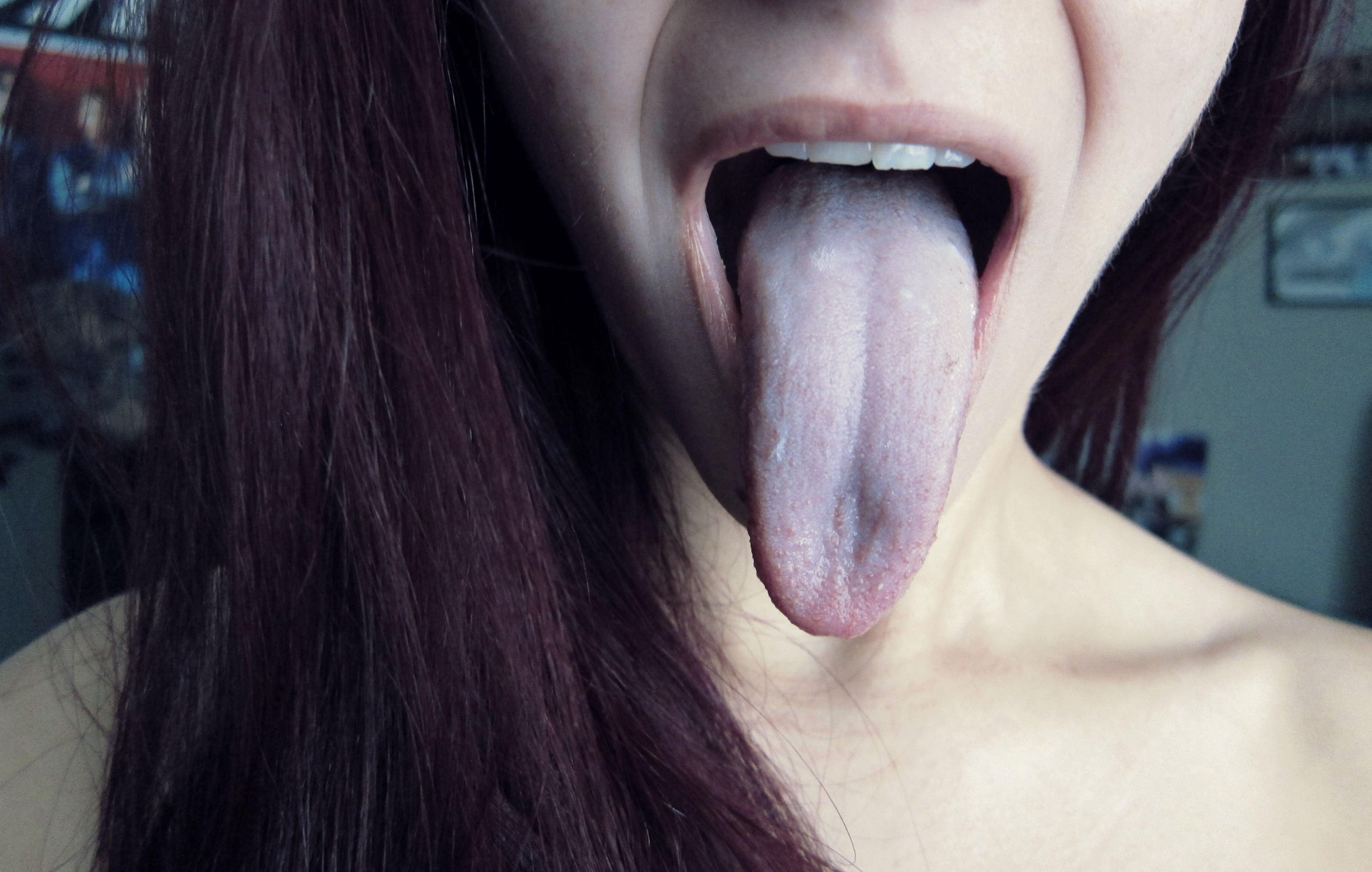 IMG Oral Invitation — 8