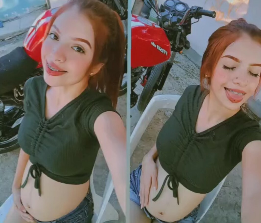 Redhead — 49